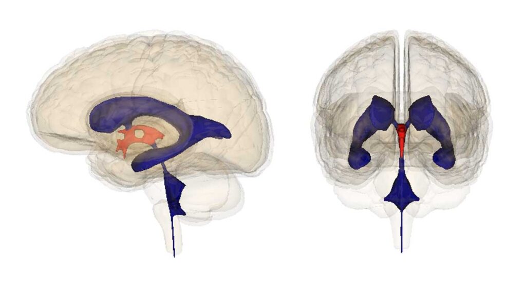 Por los ventrículos cerebrales circula el líquido cefalorraquídeo que tiene funciones protectoras.